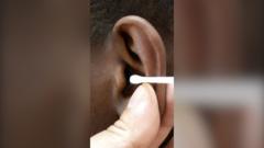 Should we be using cotton buds to clean our ears?